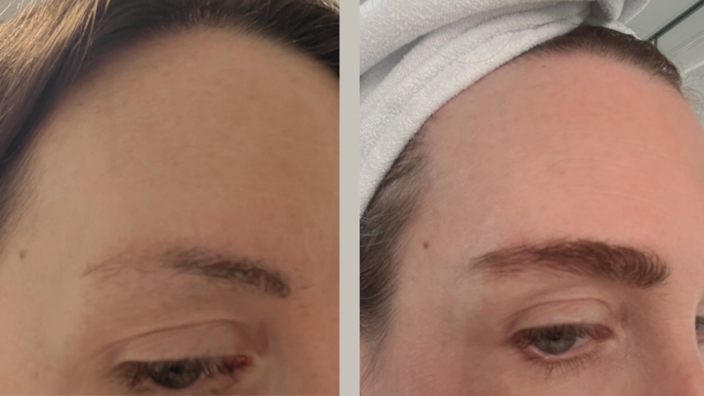 before and after nulastin eyebrow serum